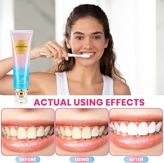 Nicotinamide Whitening Toothpaste